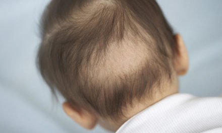 Jak zwiększyć ilość baby hair?