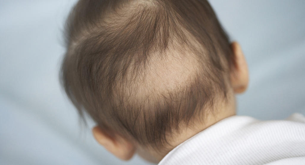 Jak zwiększyć ilość baby hair?