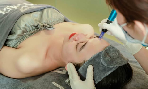 Mezoterapia igłowa twarzy – na czym polega zabieg i jakie daje efekty?